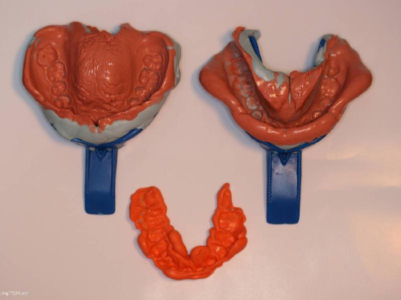 牙科印模膠圖片/牙科印模膠樣板圖 (2)