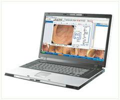 供應(yīng)筆記本腹腔鏡工作站