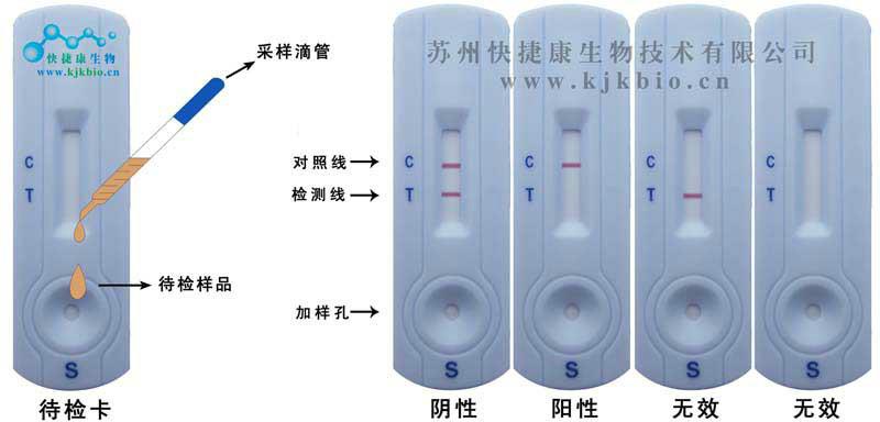 供应沙丁胺醇检测卡