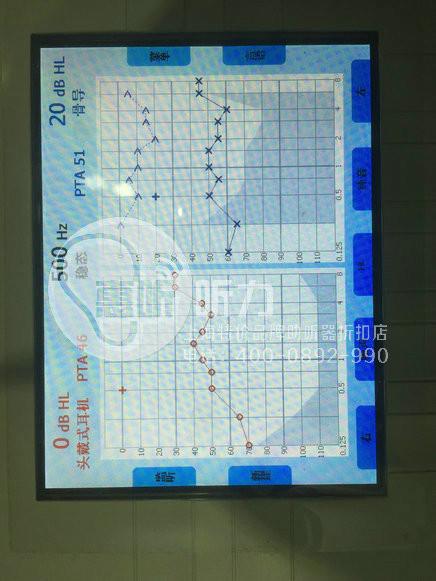 供应上海杨浦助听器专卖店五折起